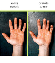 Load image into Gallery viewer, Stone Callus Remover